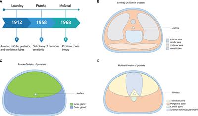 Differences in the pathogenetic characteristics of prostate cancer in the transitional and peripheral zones and the possible molecular biological mechanisms